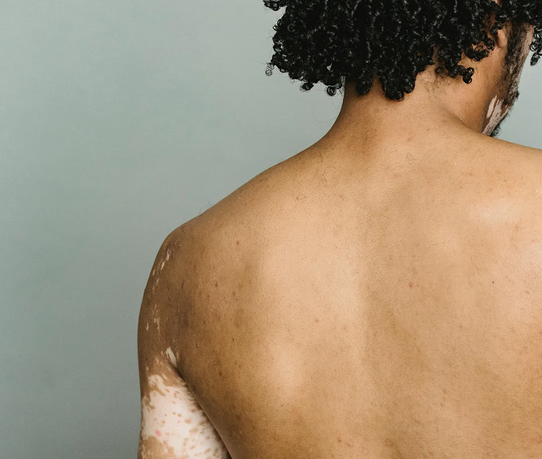 Back Skin