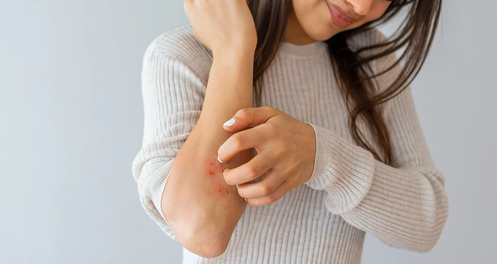 Psoriasis
